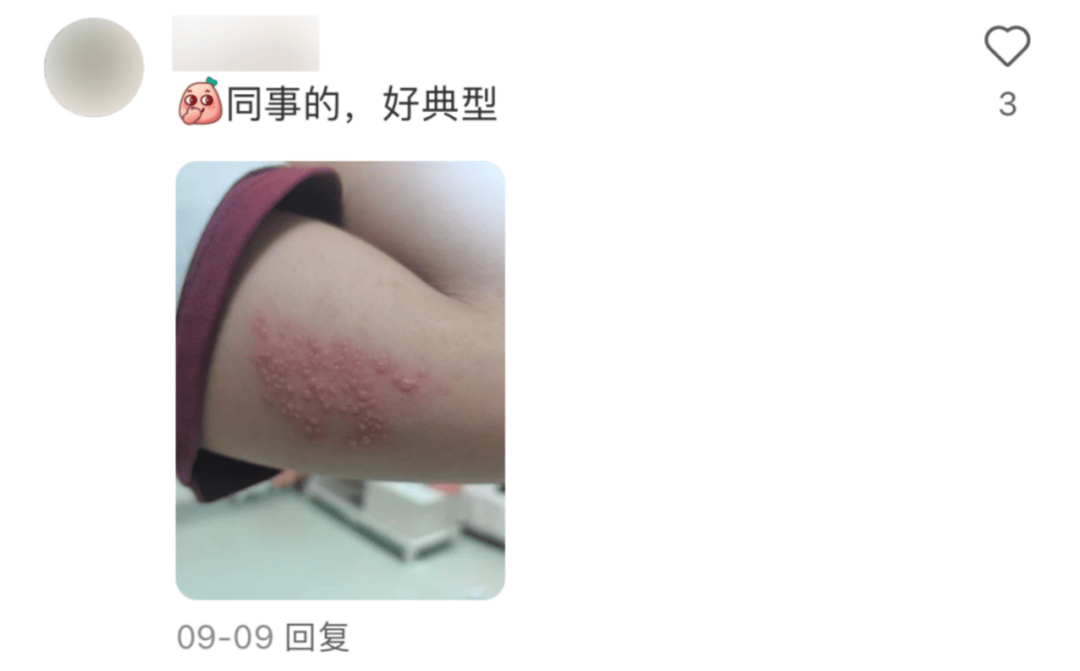 一旦感染终身携带<strong></p>
<p>证券交易费用</strong>！深圳疾控提醒：这4类人要注意