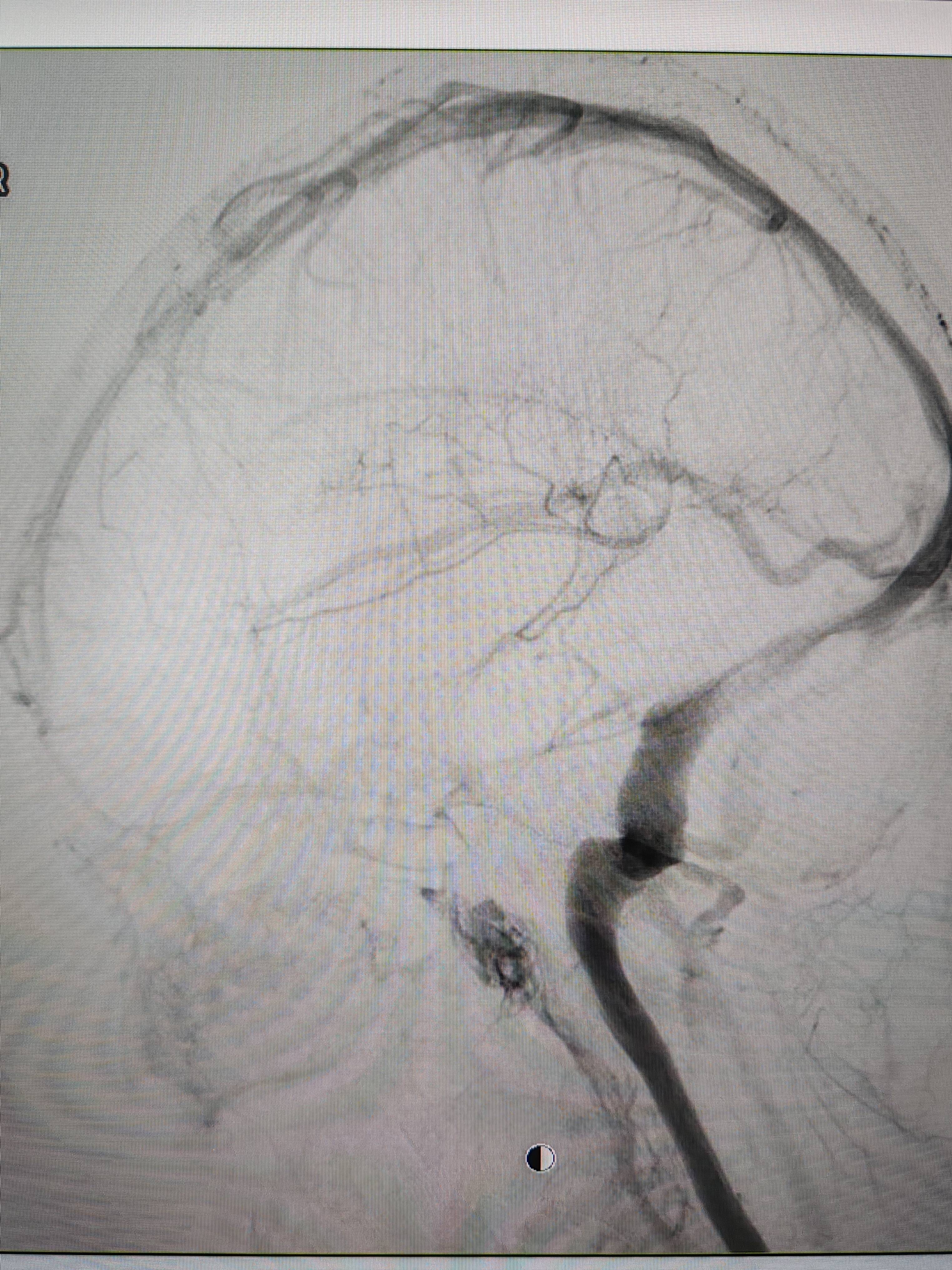 吉林女子患罕见耳鸣7年<strong></p>
<p>证券市场基础知识</strong>，慕名千里来顺德寻医终获新生
