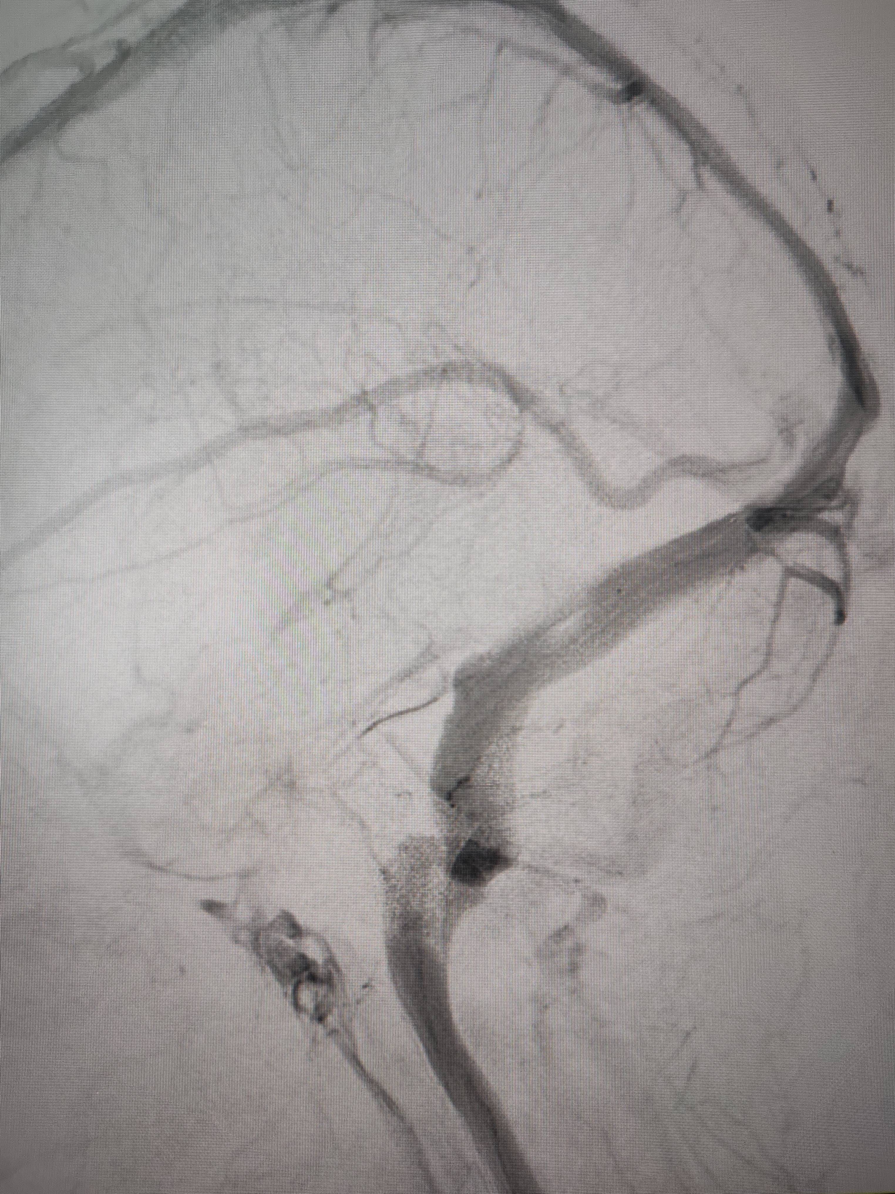 吉林女子患罕见耳鸣7年<strong></p>
<p>证券市场基础知识</strong>，慕名千里来顺德寻医终获新生