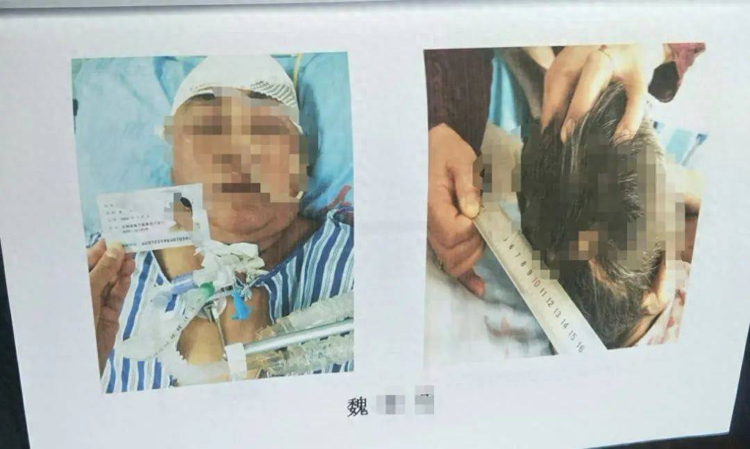 目睹母亲过马路被车撞<strong></p>
<p>虚拟币交易源码</strong>，27岁女子受惊吓5天后身亡