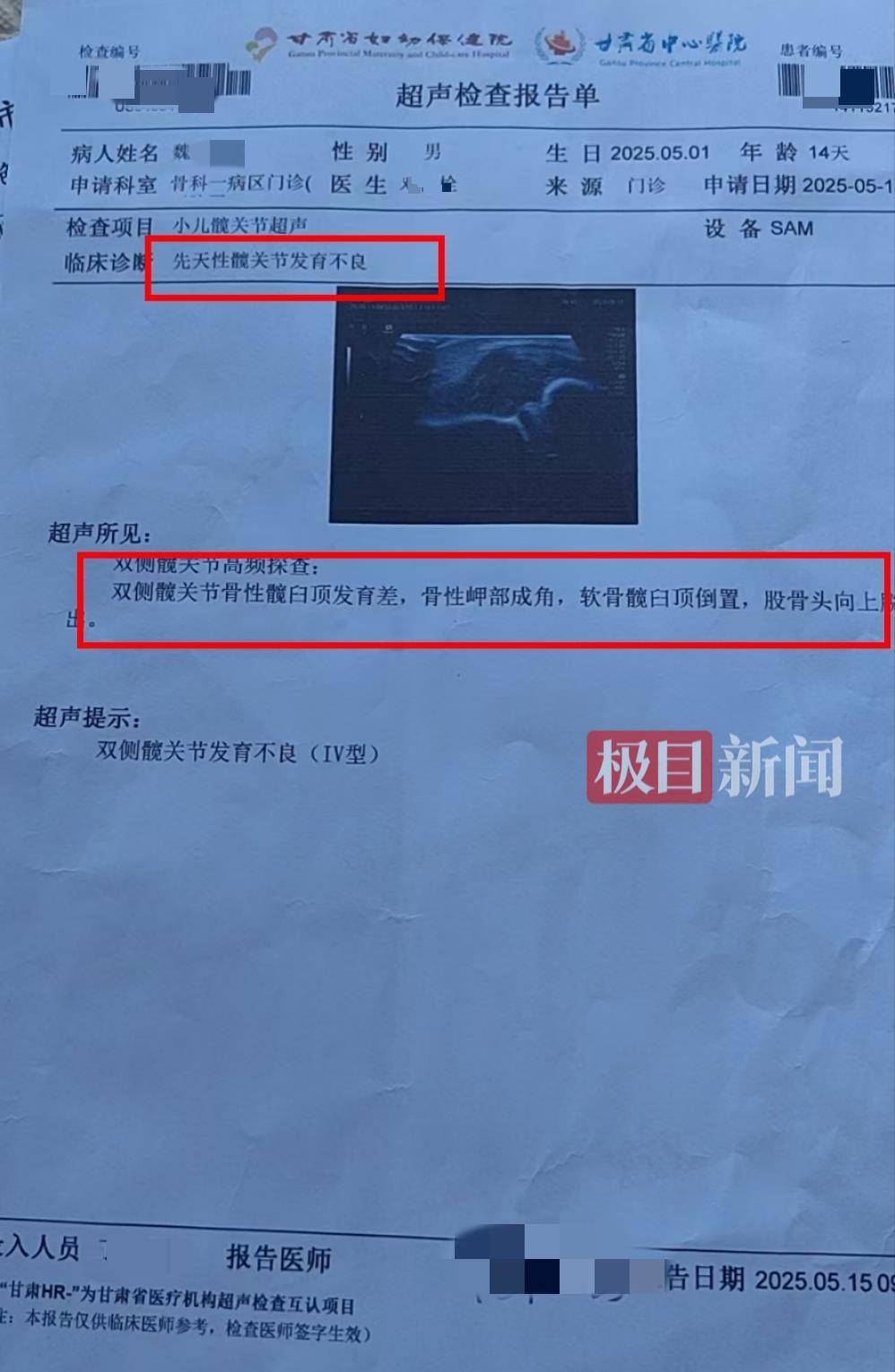 二胎出生查出先天性病症或落下残疾<strong></p>
<p>虚拟币eos</strong>，残疾父母称医院产检漏检、未尽告知义务，医院及医调委回应