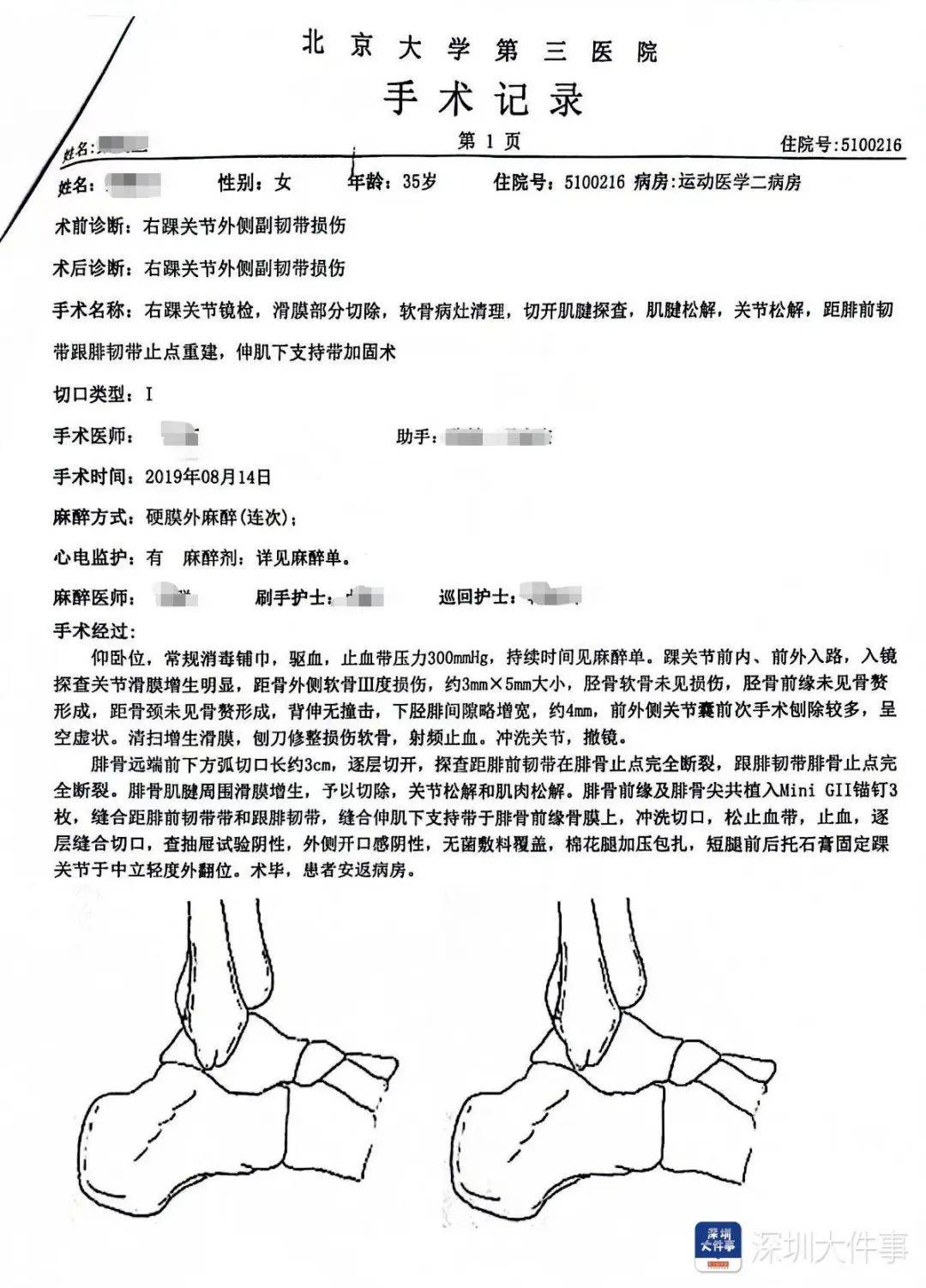 “一走路就痛”！女子脚踝受伤遭漏诊<strong></p>
<p>虚拟币查询</strong>，治了7年没好！深圳一医院被告上法庭