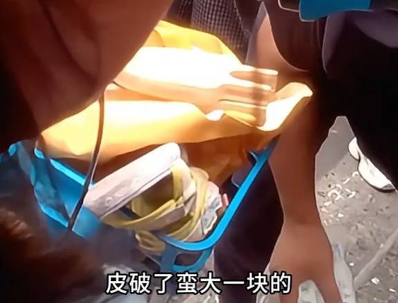 看着都疼<strong></p>
<p>虚拟币怎么投资</strong>！上海街头一男子突然求助：10岁女儿被死死卡住！这个行为太危险→